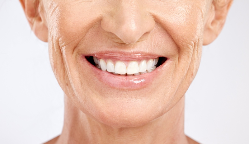 Cuántos implantes dentales se pueden poner en un día
